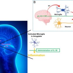 Which of the following is not a glucocorticoid effect